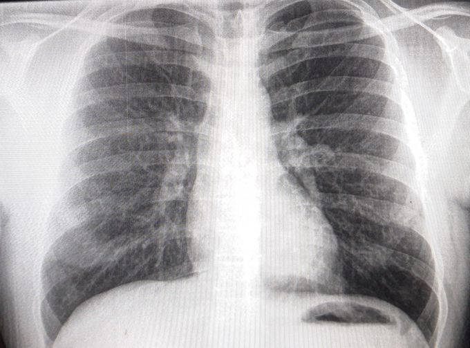Your diagnosis ??