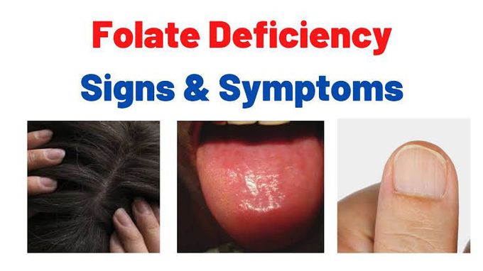 Treating folate deficiency anemia and its symptoms