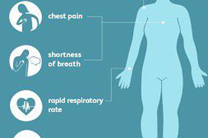 Pleurisy