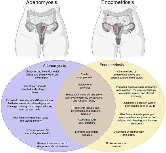 Endometriosis - MEDizzy