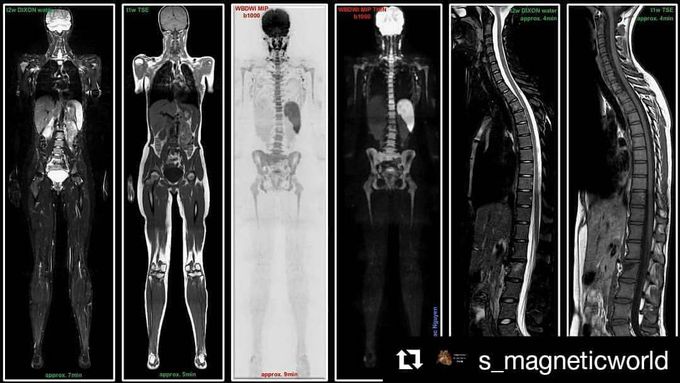 WB-MRI