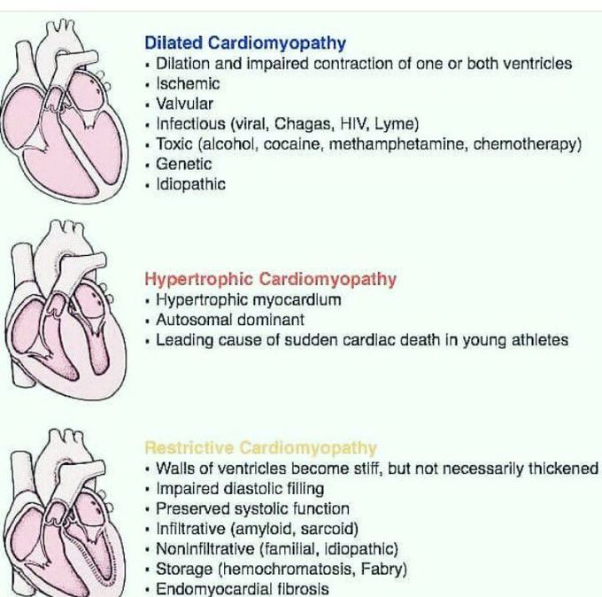 Cardiomyopathy presentations.