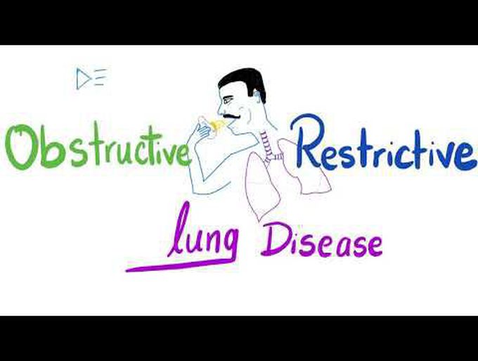 Comparison between Chronic and Obstructive pulmonary disease