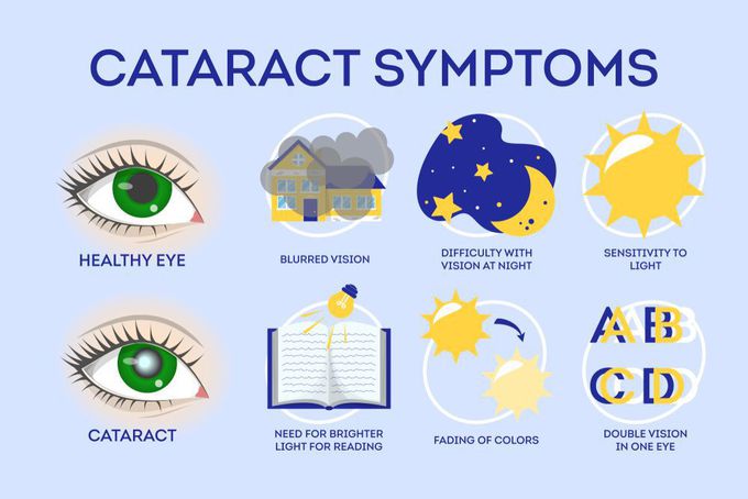 Symptoms of Cataract