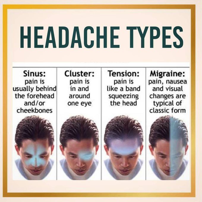 Types of headache