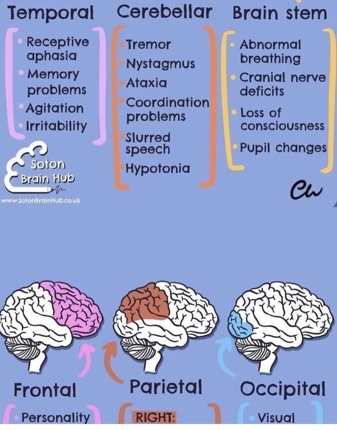 Areas of the Brain