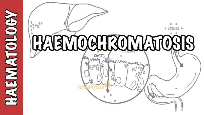 Haemochromatosis (Iron Overload)