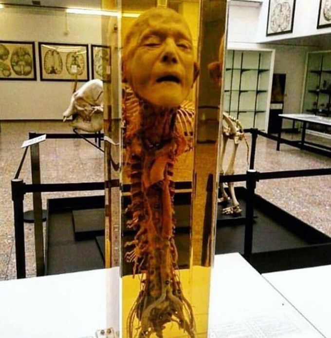 A rare preservation