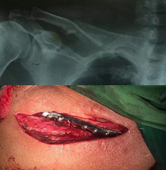 orthopedic surgery