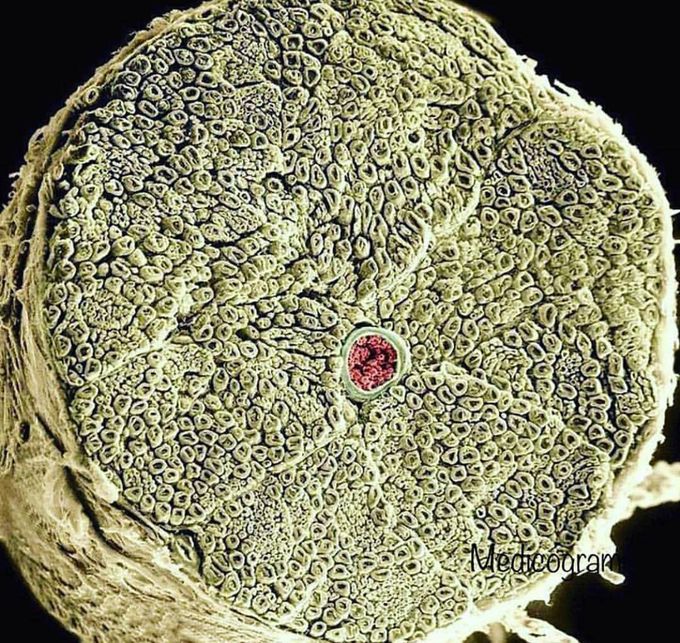 Incredible coloured scanning electron micrograph (SEM) of section through a human spinal nerve