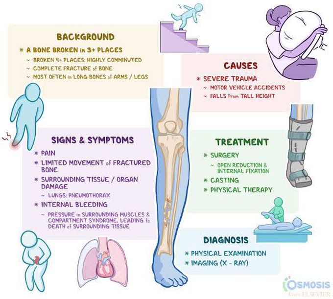 Comminuted fracture