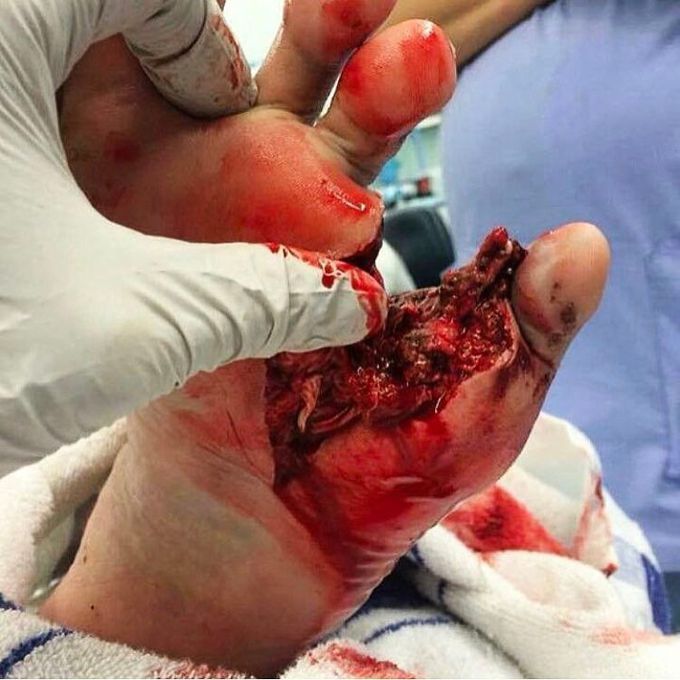 When an accident catches you off guard!
