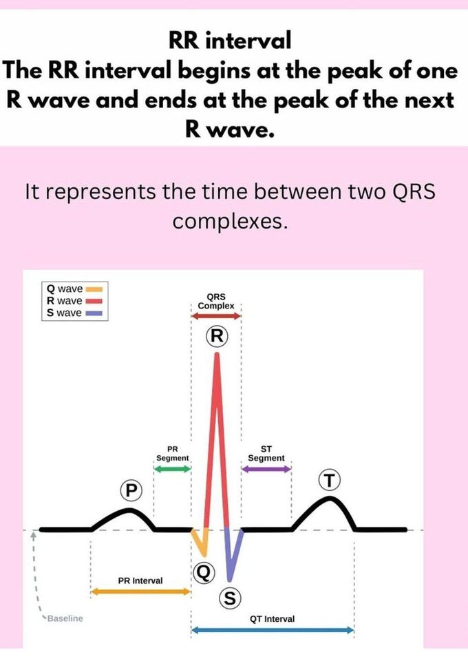 ECG Basics VI