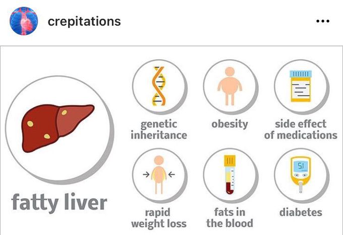 Steatohepatitis