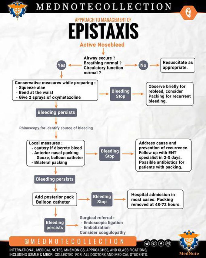 🧠 MANAGEMENT of EPISTAXIS