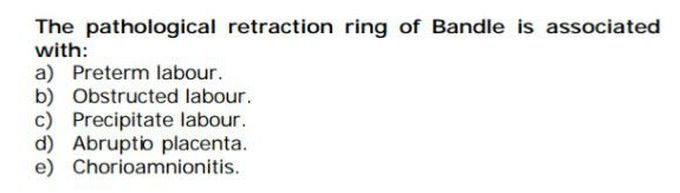 Ring of bandle