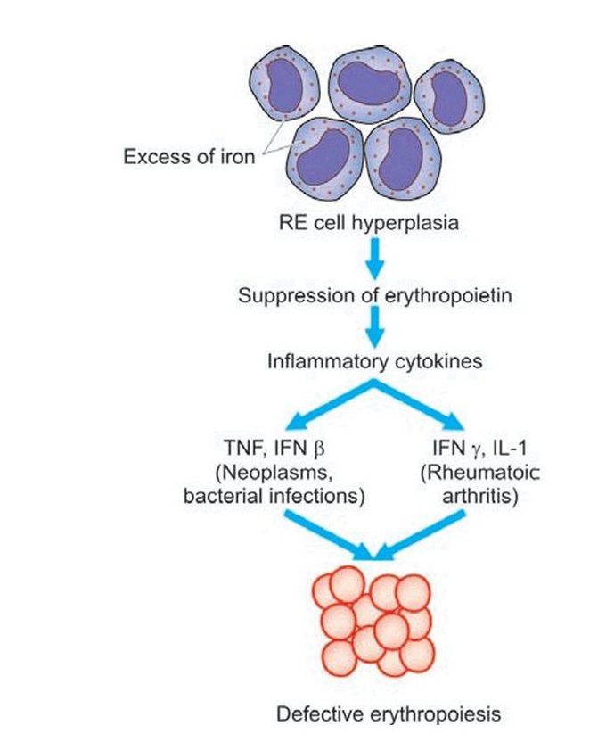 Anaemia of chronic disorders