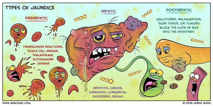 Types of Jaundice