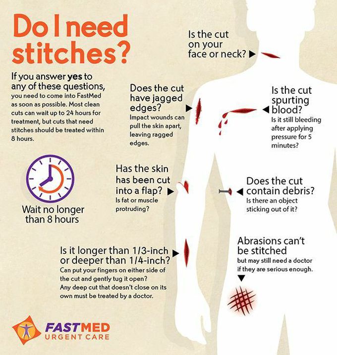 Do I Need Stitches? What You Need to Know - GoodRx