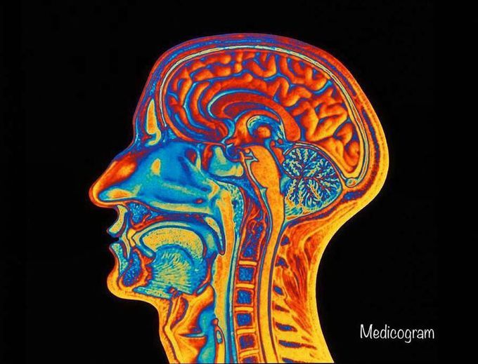 Coloured MRI