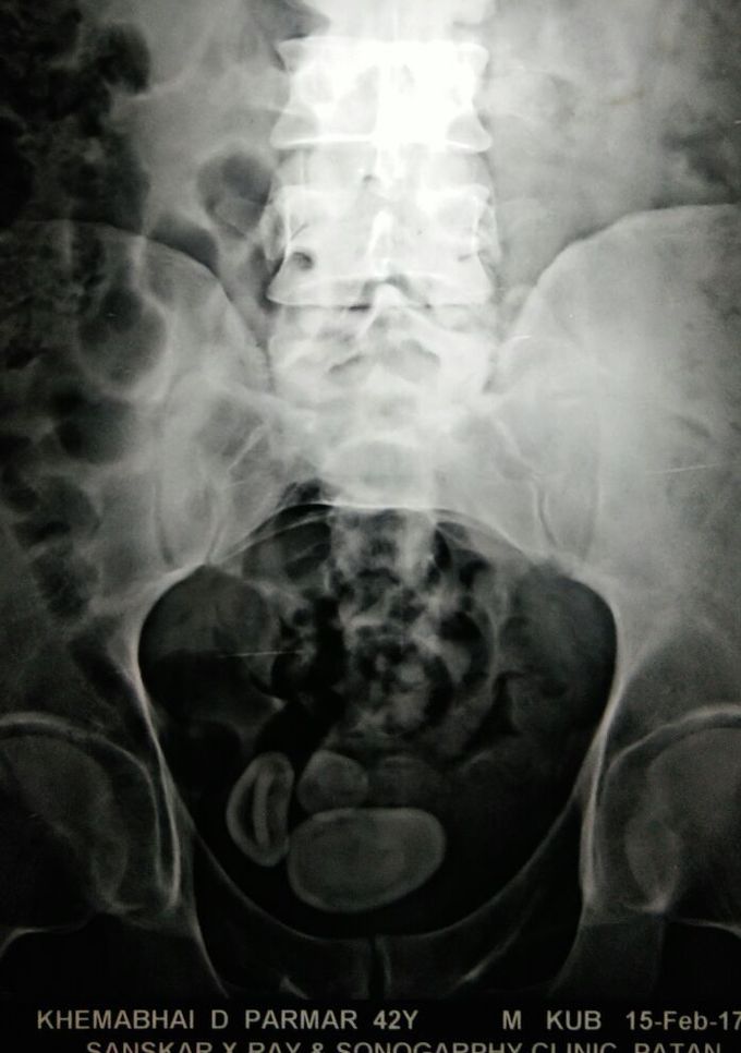What's your diagnosis.....??