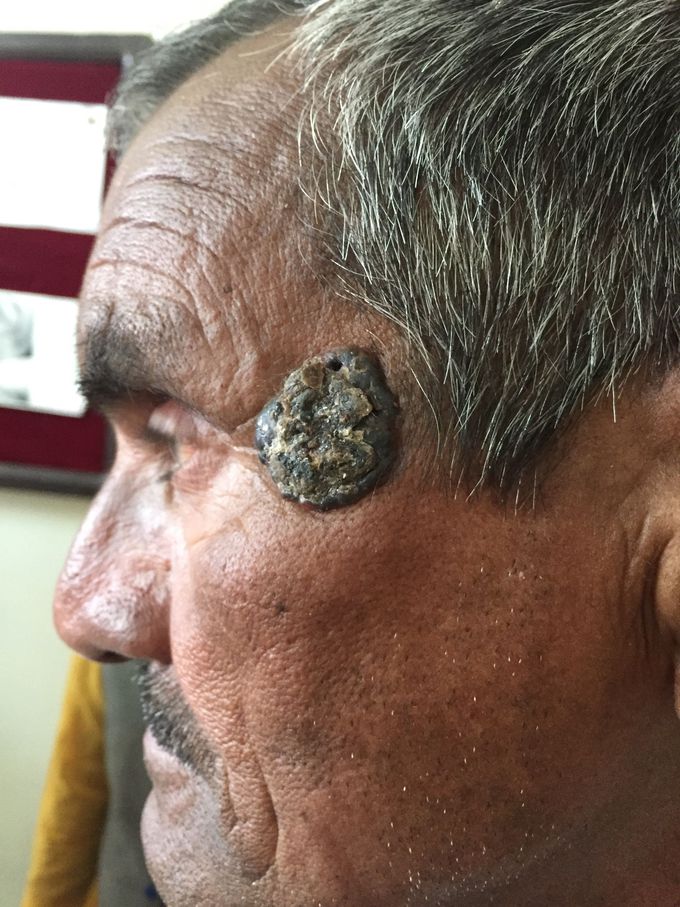 Diagnosis??