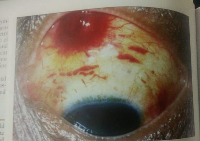 Guess the condition