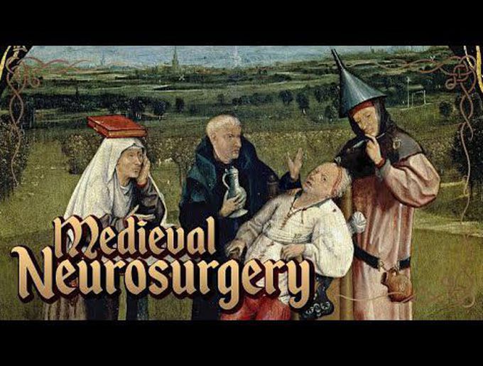 History of Neurosurgery in The Middle Ages