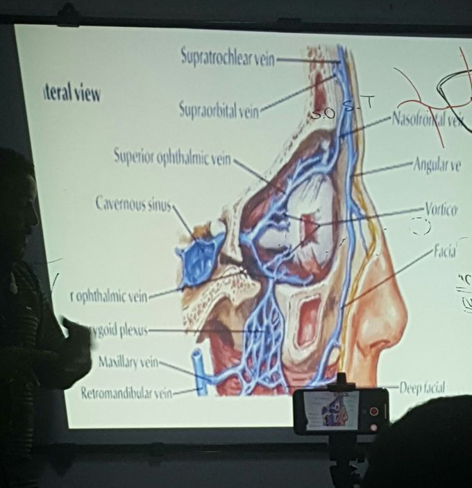 Venous drainage 😥