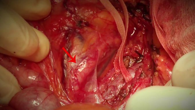 Find the Structure | Anatomy / Surgery Quiz |
