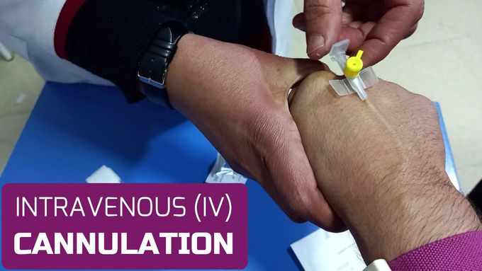 Intravenous (IV) Cannulation Guide