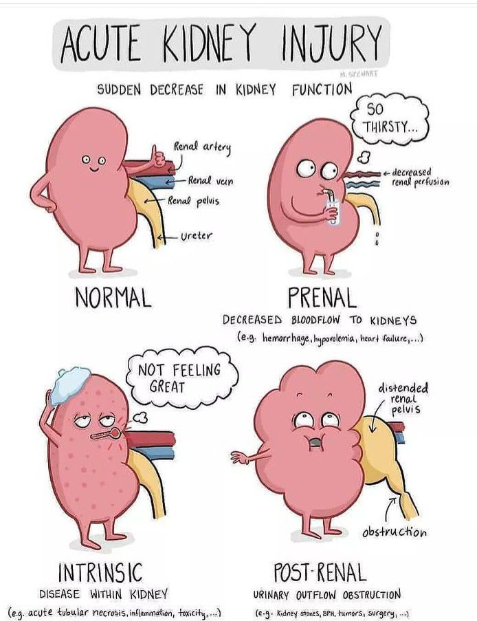 acute-kidney-injury-medizzy