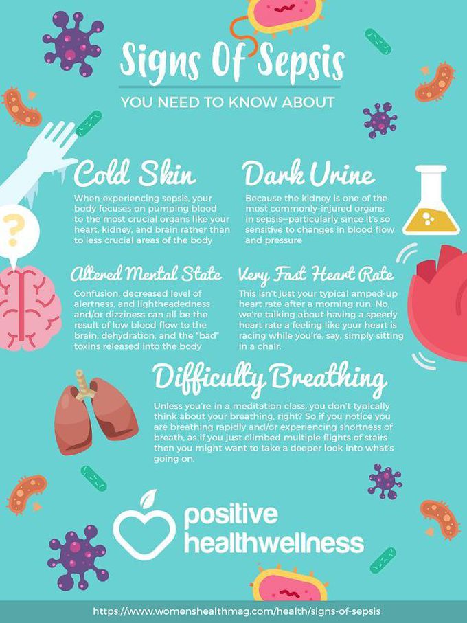 Signs of sepsis in newborn