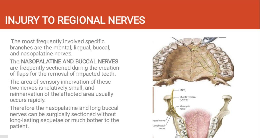 PostOp Nerve Damage - MEDizzy