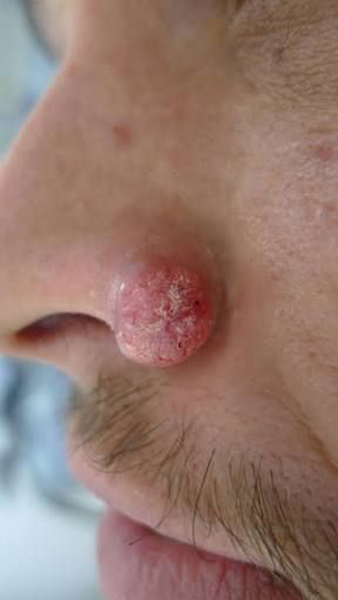 What is diagnosis?