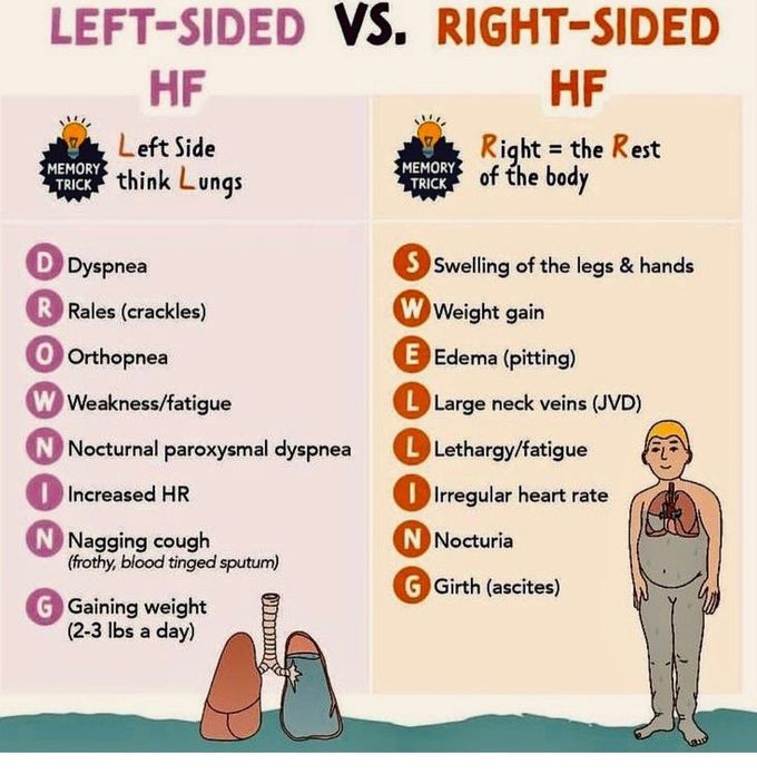 Left Sided Vs Right Sided Heart Failure