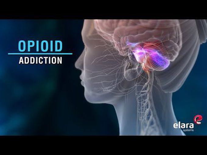 What is Opioid Addiction?