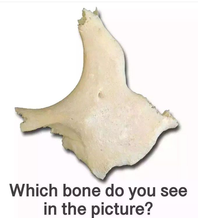 Identify the Bone