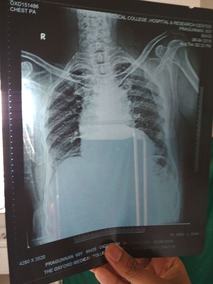 What your diagnosis??