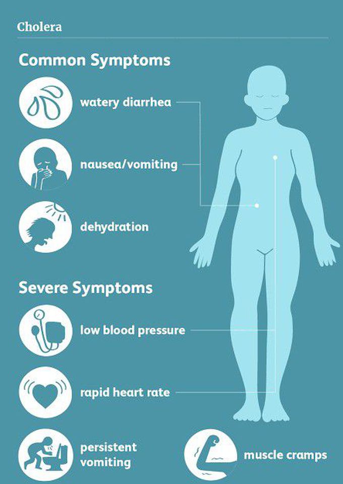 Cholera symptoms