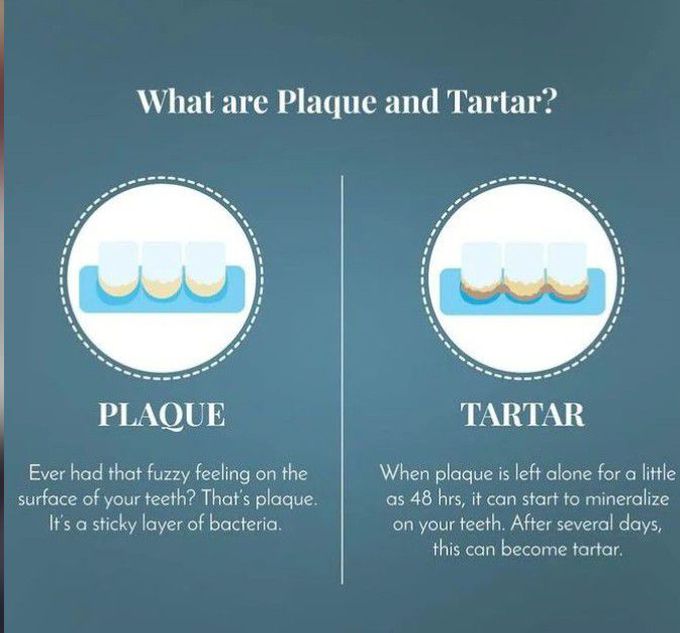 Plaque Vs Tartar