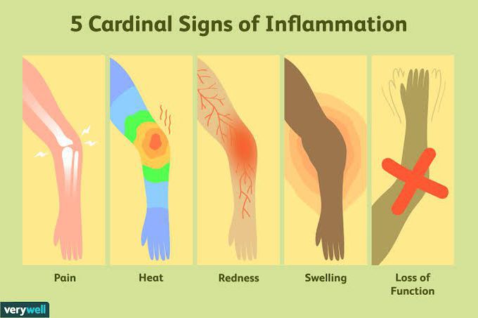 Cardinal Signs of Inflammation
