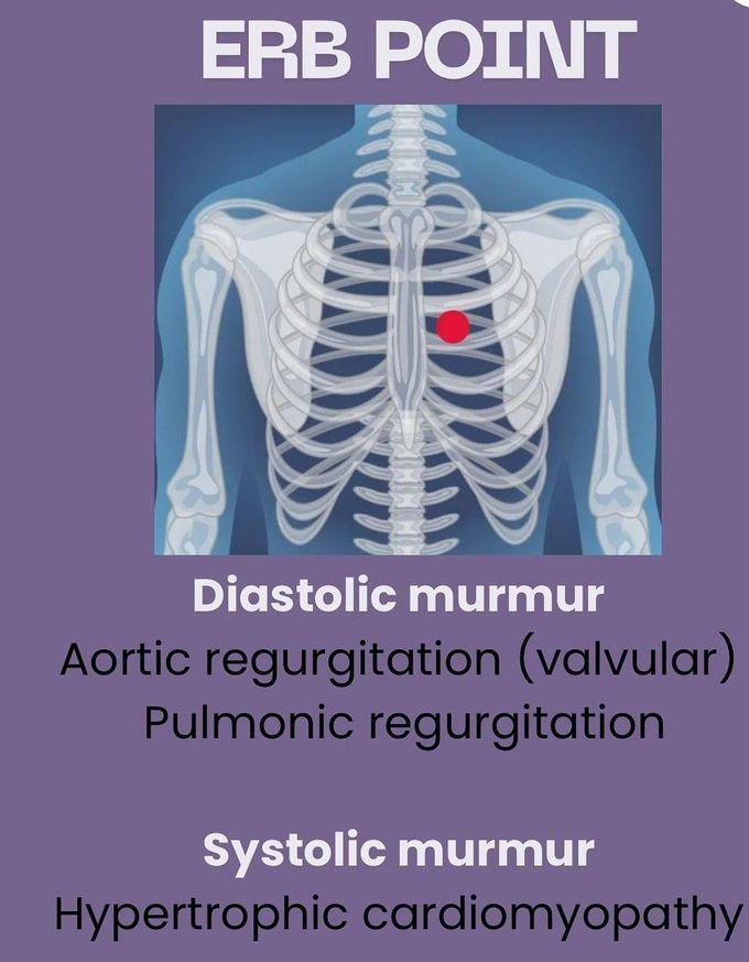 Heart Murmurs III