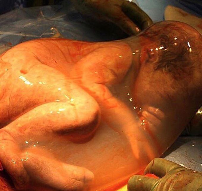 Breathing inside the amniotic sac