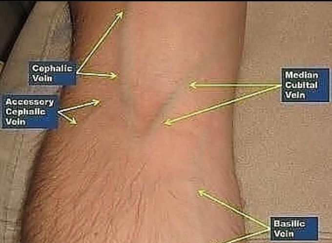 ANATOMY OF CUBITAL FOSSA