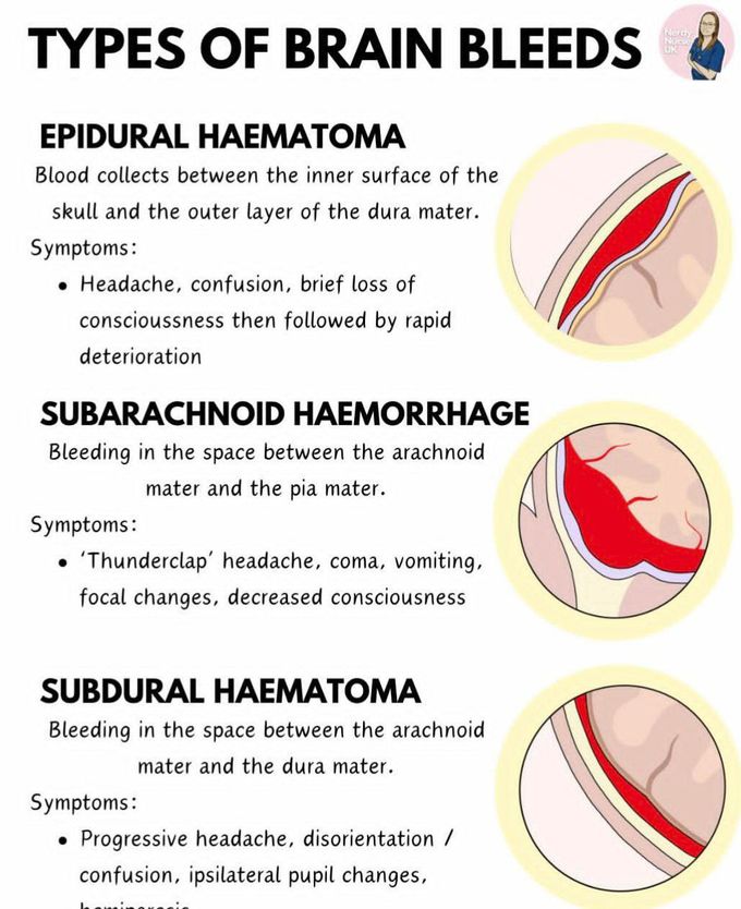 Types of Brain Bleed