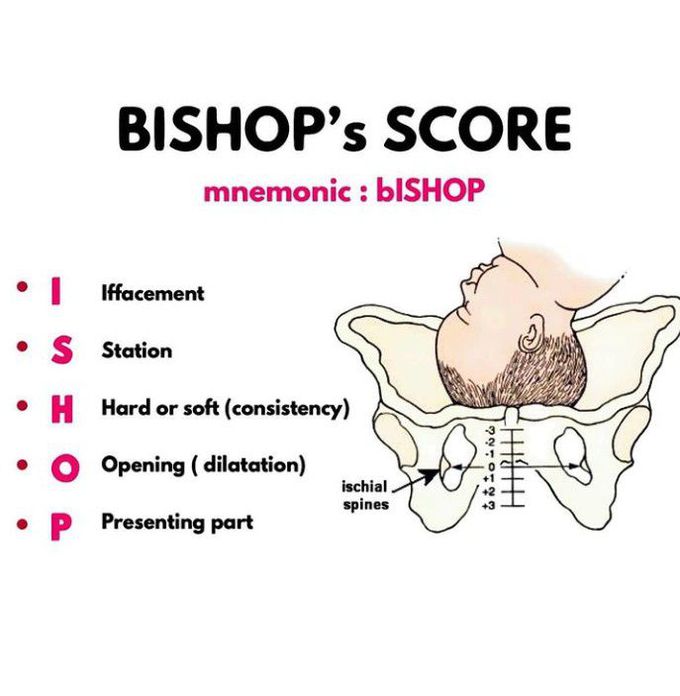 Bishop's Score