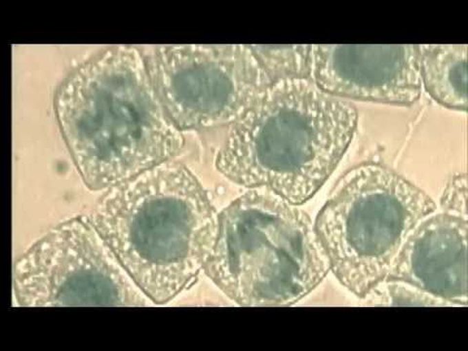 Histology of Mitosis