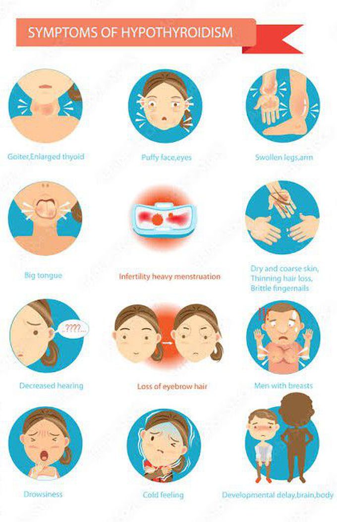 Here are the symptoms of hypothyroidism