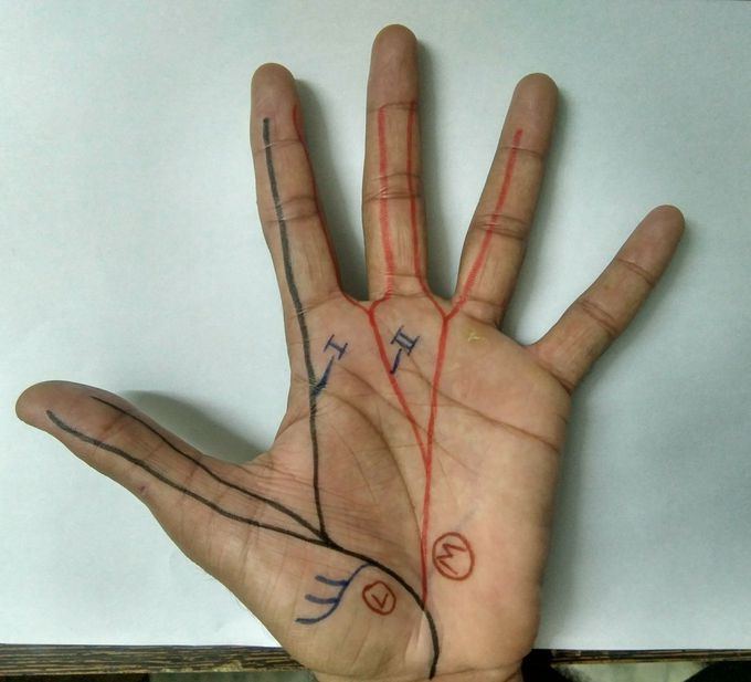 Median nerve branches in hand